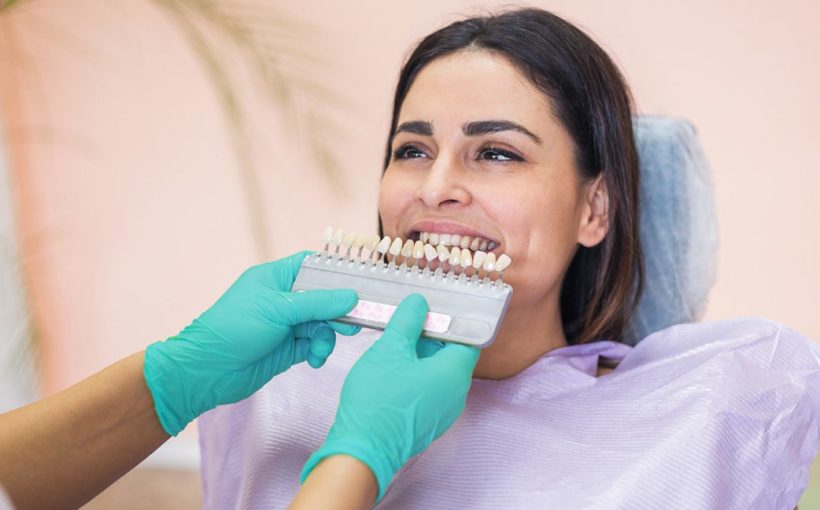 using ceramic crowns