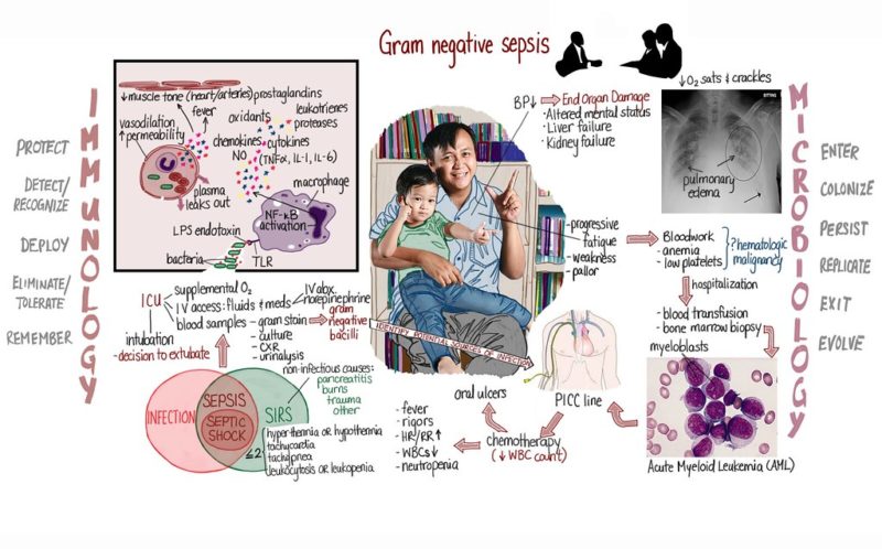 Sepsis Infection