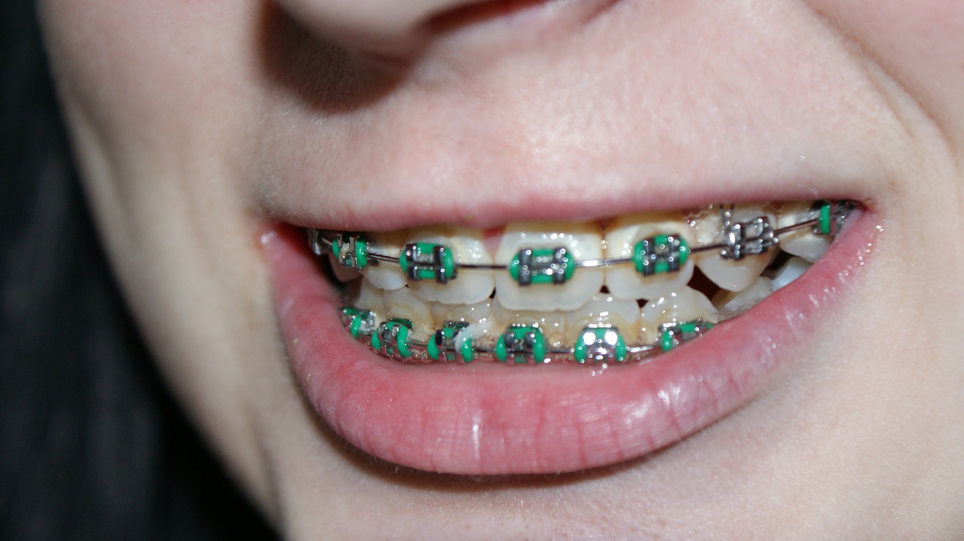 teeth-
