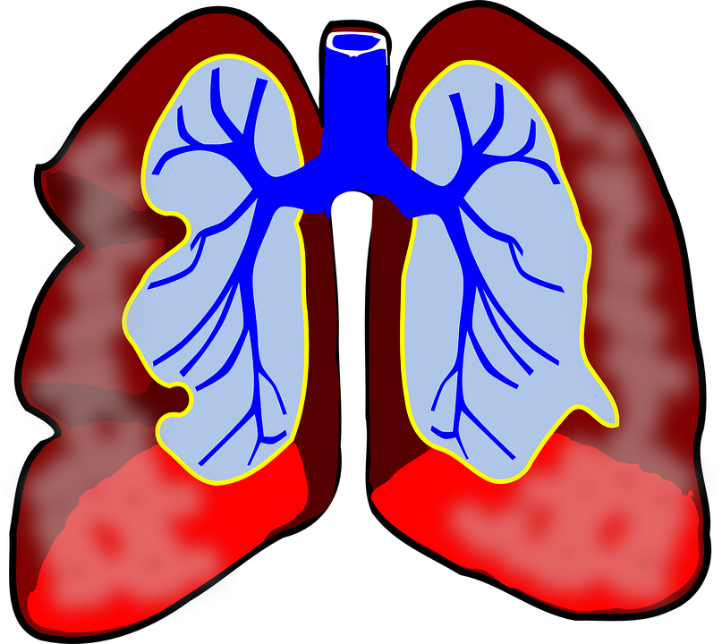 Lung Infection