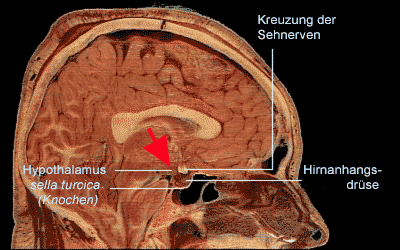 Hypothalamus