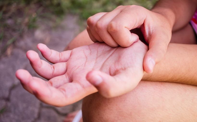 Itchy Hands Can Be a Skin Problem, Not Just a Superstition