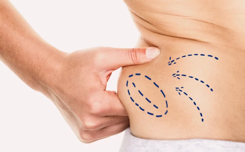 A Comprehensive Guide to Different Types of Weight Loss Treatments
